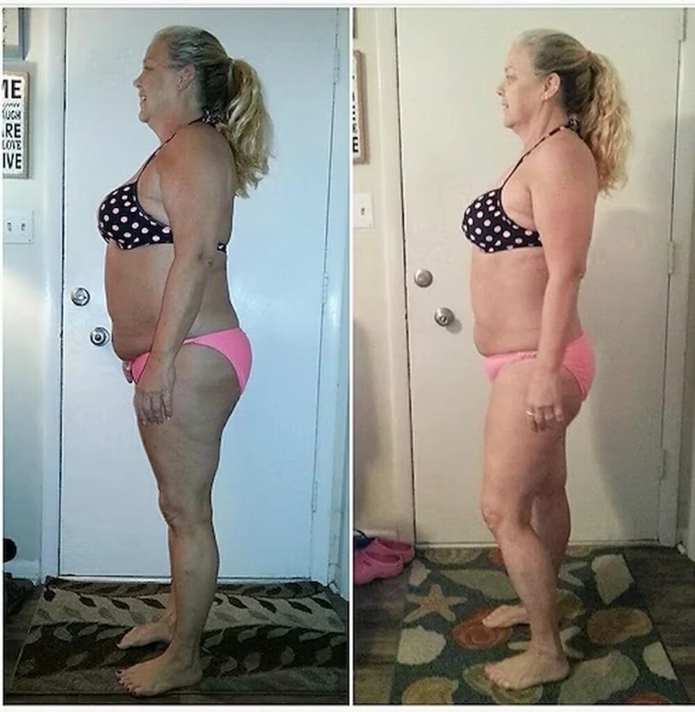 LipoFlow customer